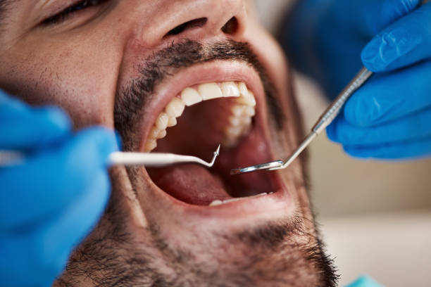 Best Emergency Treatment for Dental Infections or Abscesses in Mishicot, WI