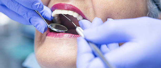 Best Emergency Dental Care for Broken or Chipped Teeth in Mishicot, WI